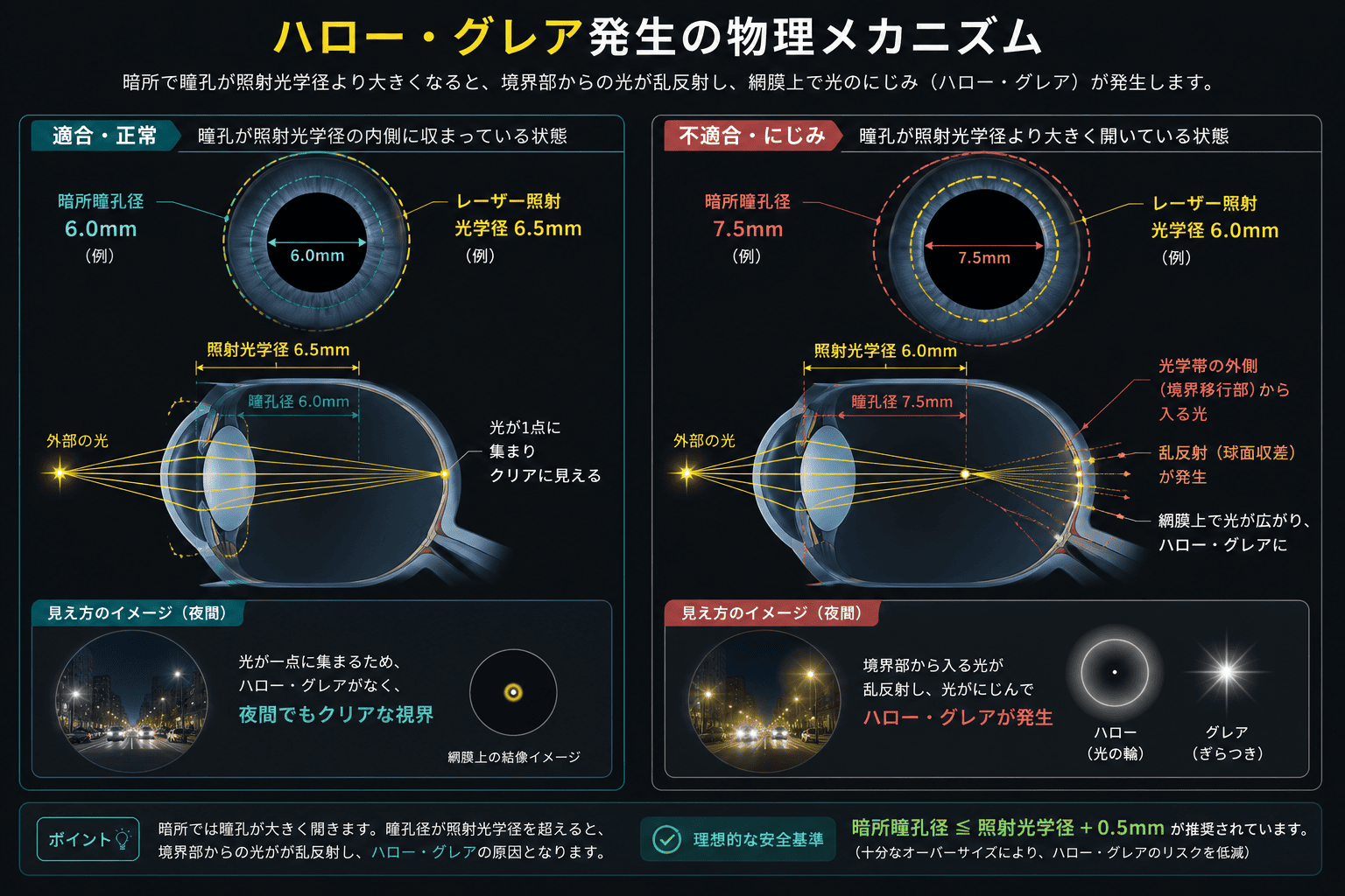 夜間に瞳孔が開き、レーシックの照射径を超えてしまった際に、境界部からの光がにじみハロー・グレアを誘発する仕組みの幾何学的比較図。