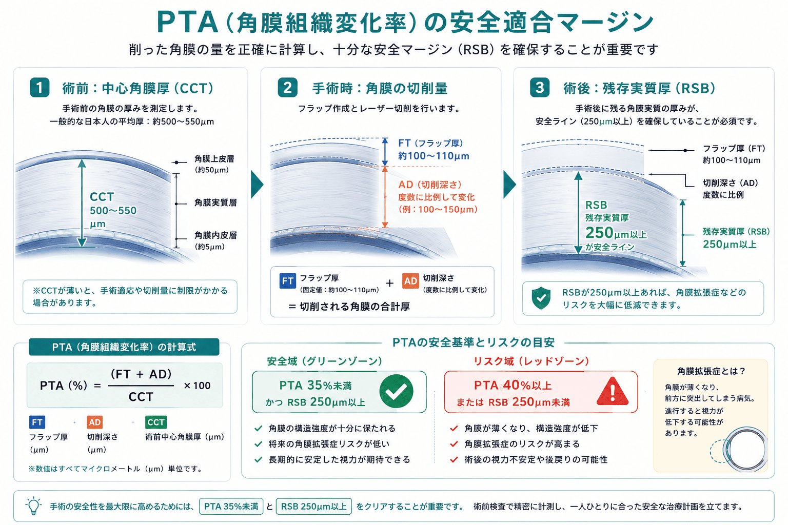 術前角膜厚、フラップ厚、切削深さから算出されるPTA(角膜組織変化率)が35%未満かつ残存角膜実質厚が250μm以上であれば安全であることを示す角膜断面のインフォグラフィック。